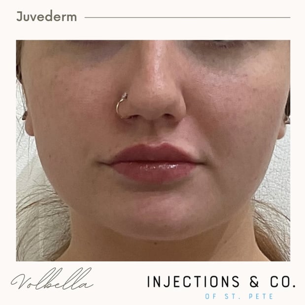 Images Injections and Co.