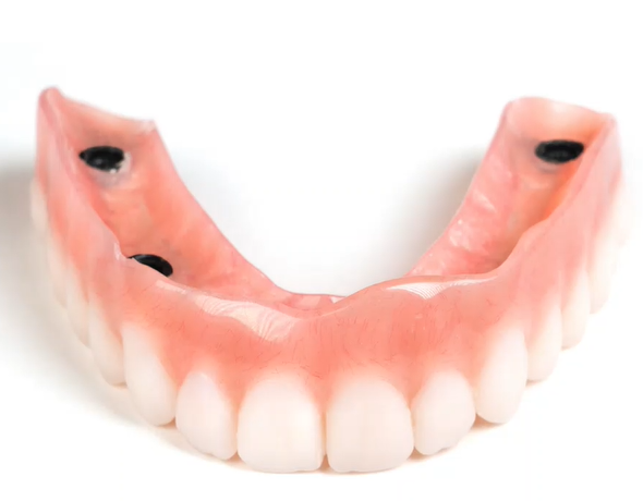 Images European Denture Center: Boise Dentures & Implants