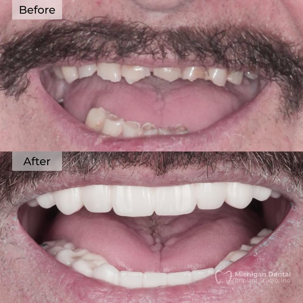 Images Michigan Dental Implant Studio