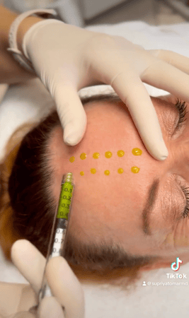 Images Supriya Aesthetic Dermatology