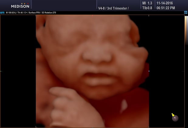 Images Heavenly 3D 4D Ultrasounds