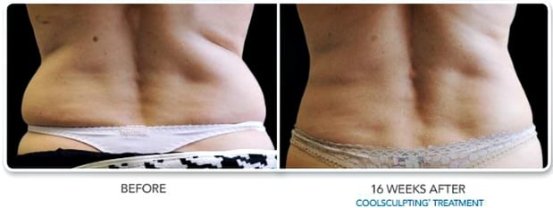 Images Hollywood Body & Face Denver/Metro