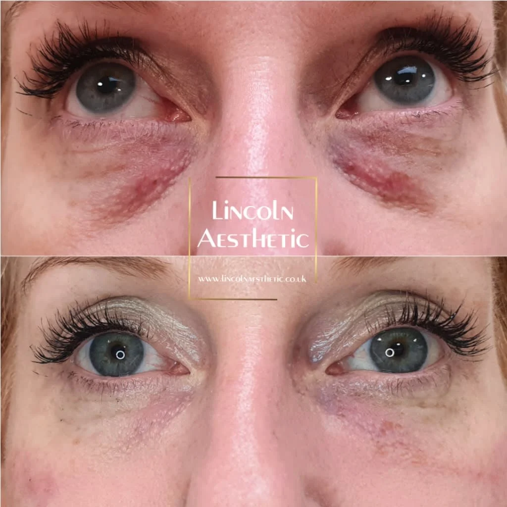 Images Lincoln Aesthetic