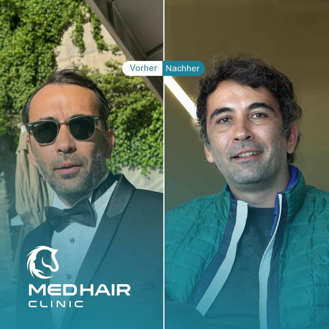 MedHair Clinic | Haartransplantationen in der Türkei Istanbul, Höninger Weg 176 in Rodenkirchen