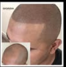 Images Giorgia Hair Clinic
