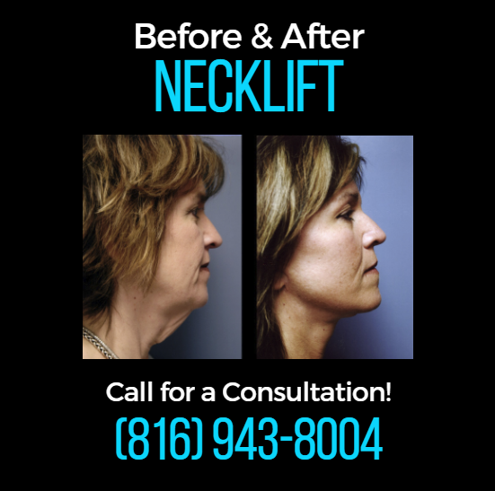 Images Dr. Joseph R. Barnthouse, MD