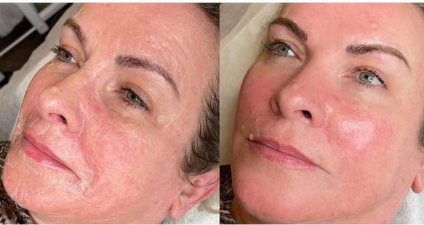 Images Permanent Makeup & Aesthetics in Maine