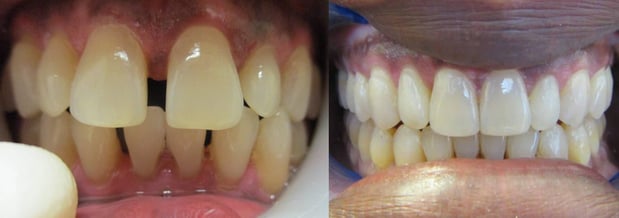 Images Premier Dental of South Orange County