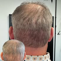 Images The Scalp Master