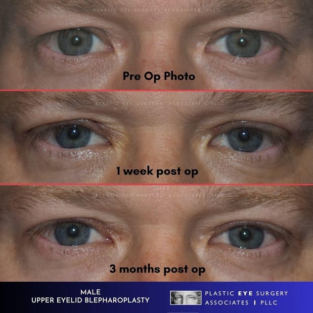 Images Plastic Eye Surgery Associates, PLLC