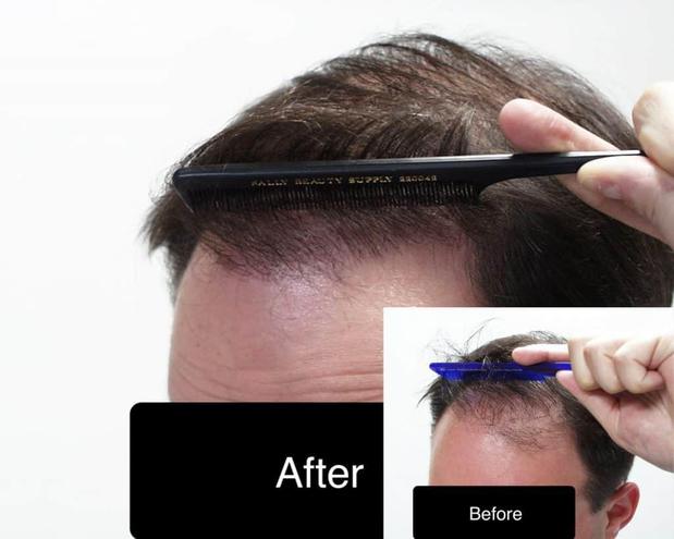 Images AZ Hair Restoration