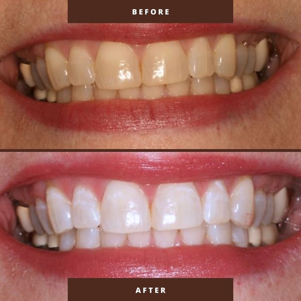 Images Victor R. Siegel, DDS