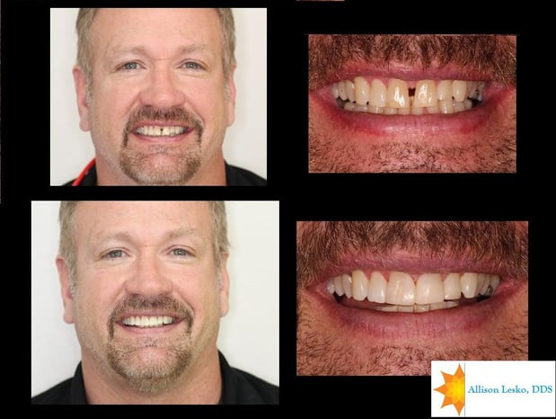 Images The Fort Collins Dentist Family and Implant Dentistry