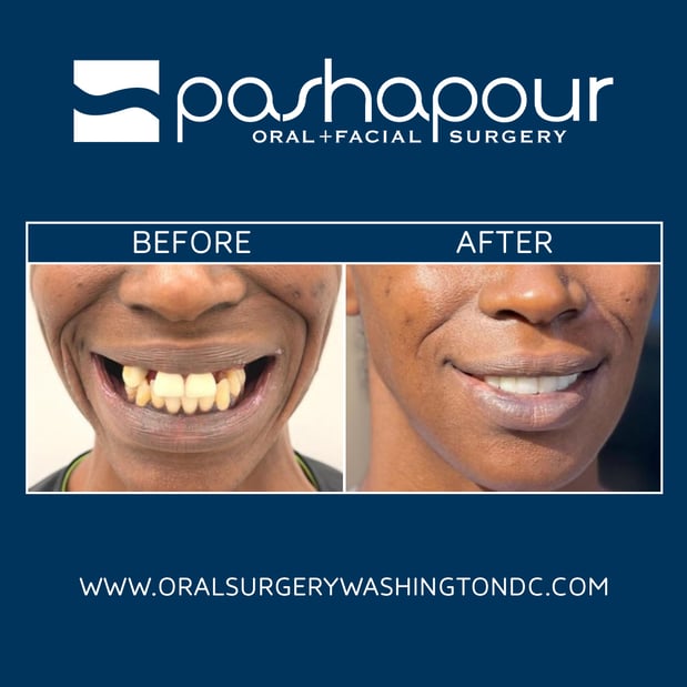 Images Pashapour Oral + Facial Surgery