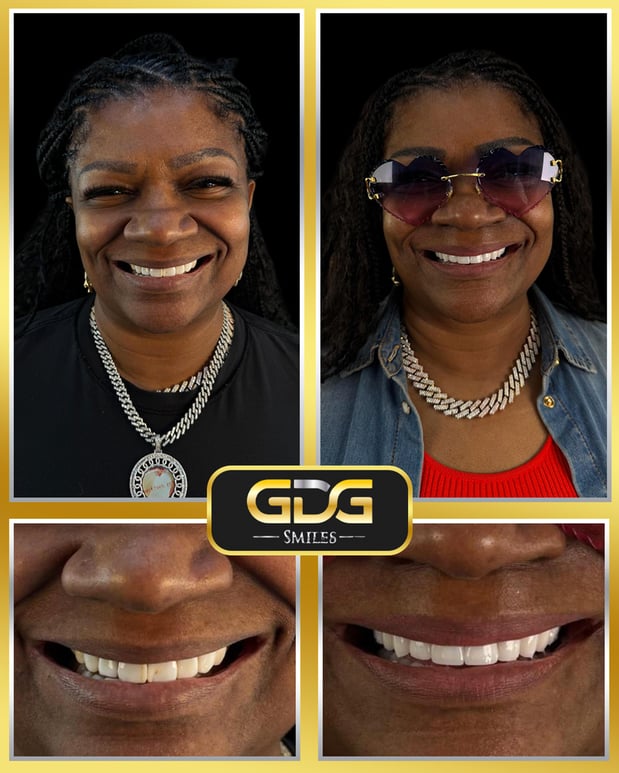 Images GDG Smiles