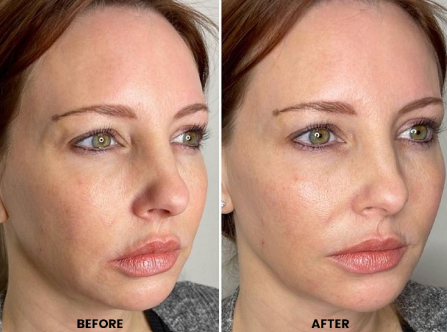 Valoura Medspa