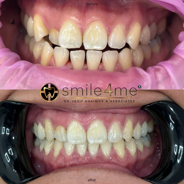 Images smile4me Dental Care - Astoria, Queens
