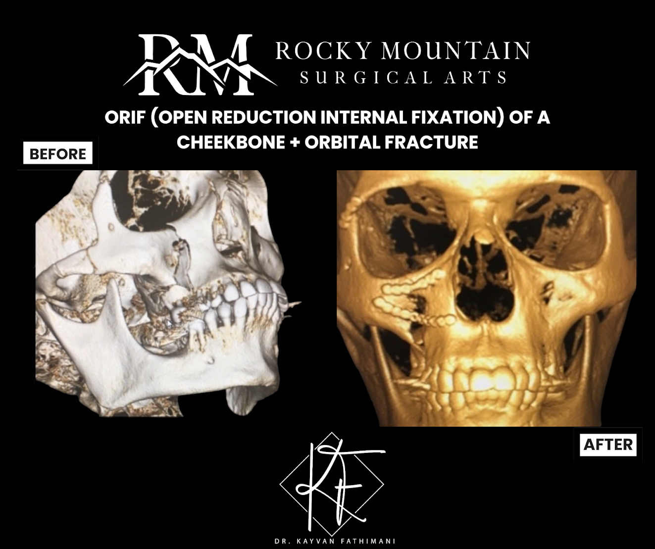 Rocky Mountain Surgical Arts