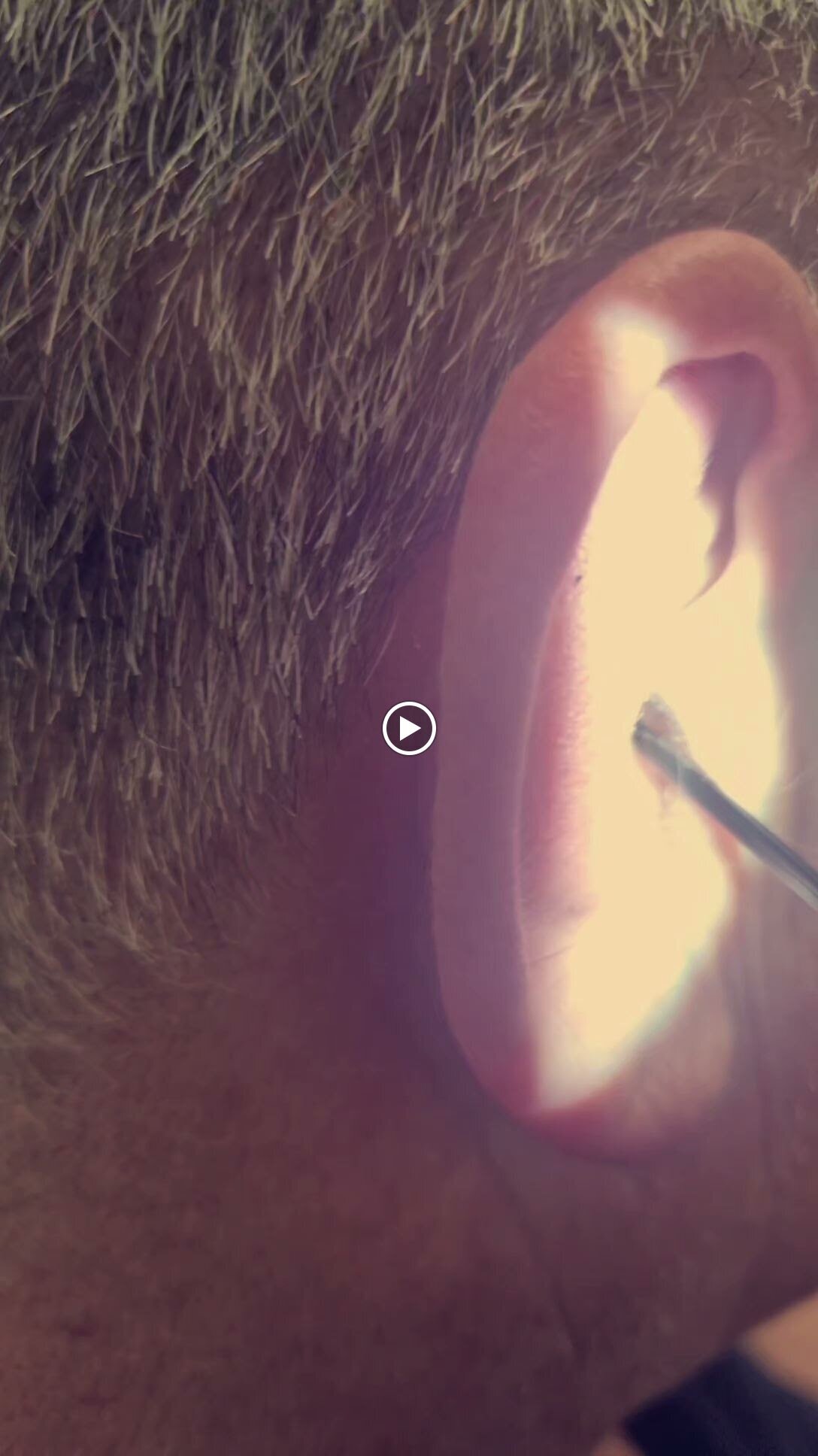 Images MW Ear Wax Removal