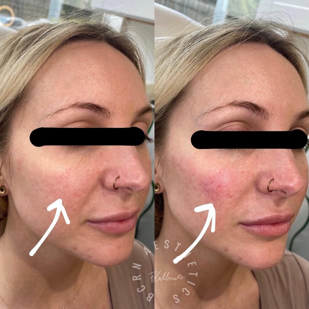 Images BCRN Aesthetics MedSpa