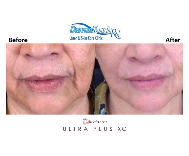 Images DermaTouch RN