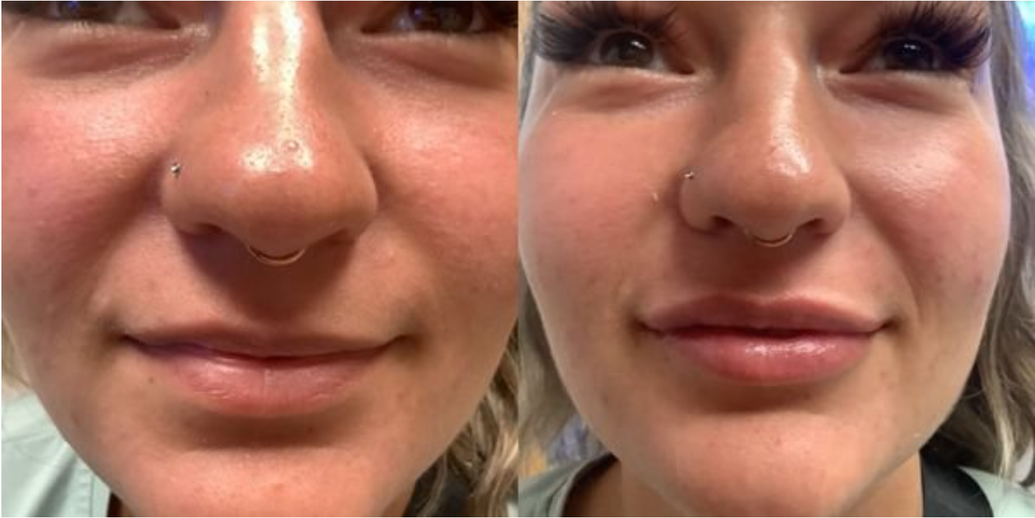 Bluewater Plastic Surgery Image