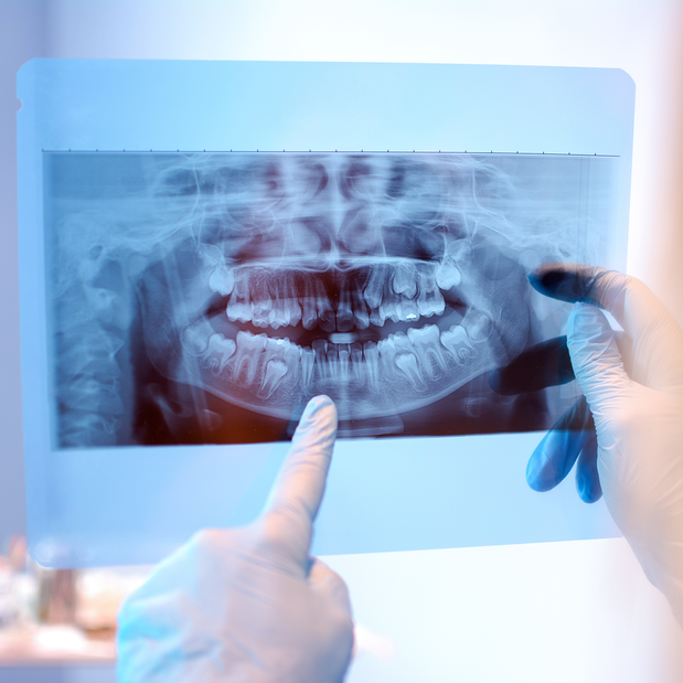 Images Advanced Oral And Maxillofacial Surgery
