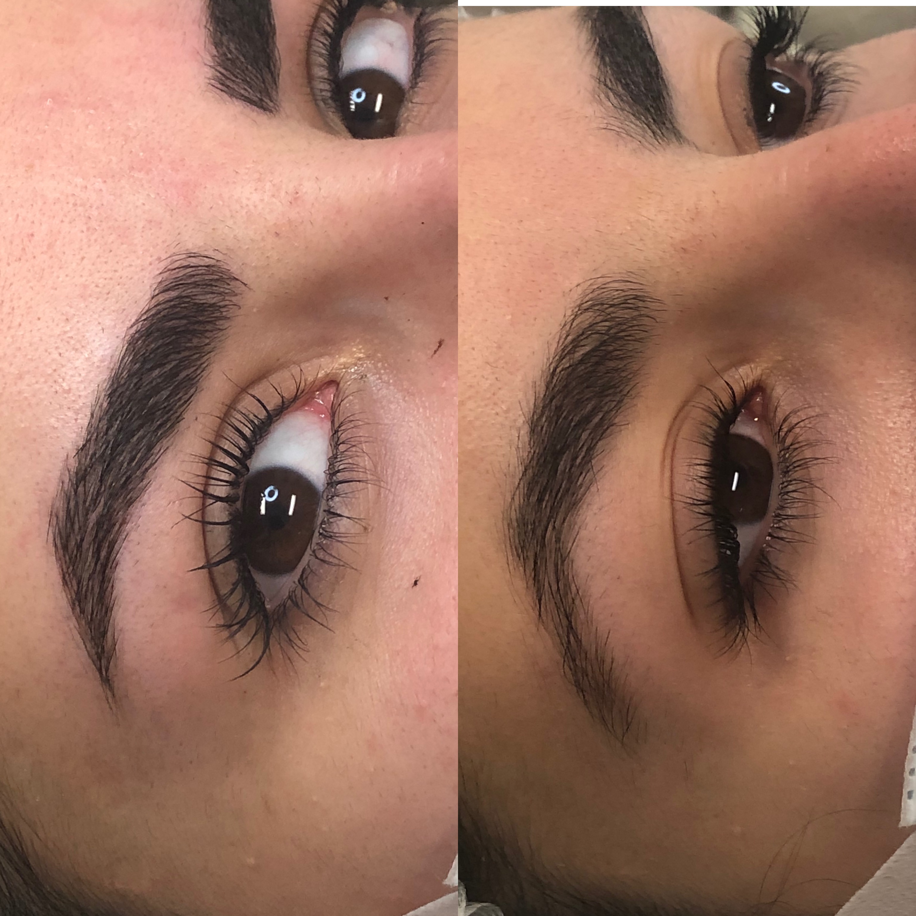 Images Clinique d'Esthétique Leila - Hydrafacial, Microblading, Épilation Laser Sainte-Foy