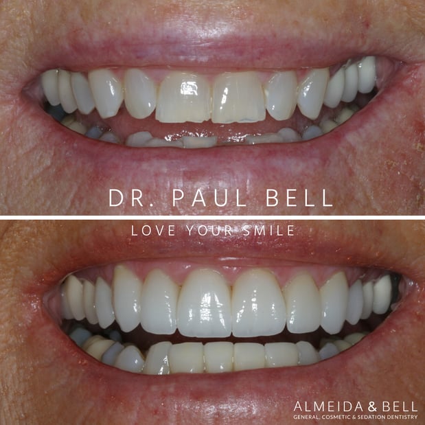 Images Almeida & Bell Dental Lone Tree - General, Cosmetic, and Implant Dentistry