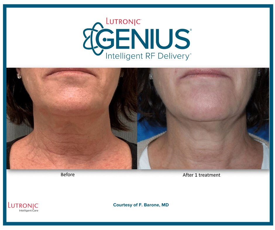 Ridgefield Aesthetics offers advanced aesthetic treatments, including dermal fillers, laser skin revitalization, and body contouring, led by Dr. Zina Boutaeva and her expert team. Prioritizing comfort, safety, and personalized care, they help clients achieve radiant skin and enhanced confidence. Visit us near downtown Ridgefield, CT.