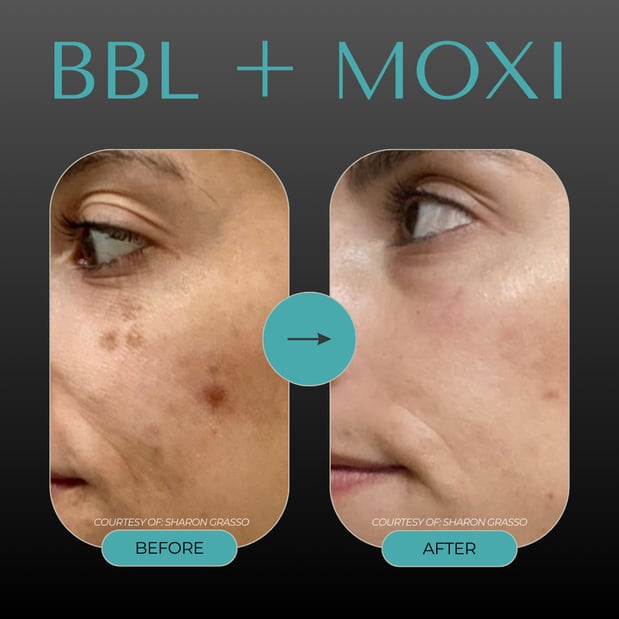 Images Musick Dermatology & Advanced Clinical Spa