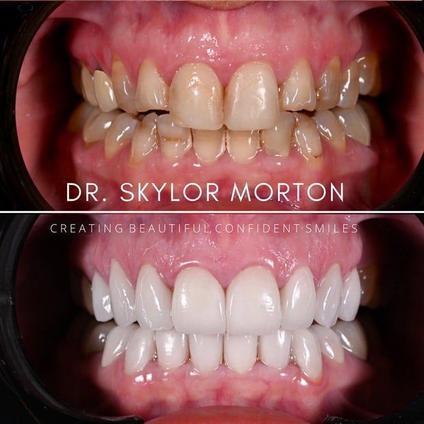 Images Nashville Wisdom Teeth and Implant Solutions