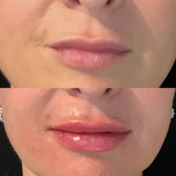 Images BCRN Aesthetics MedSpa