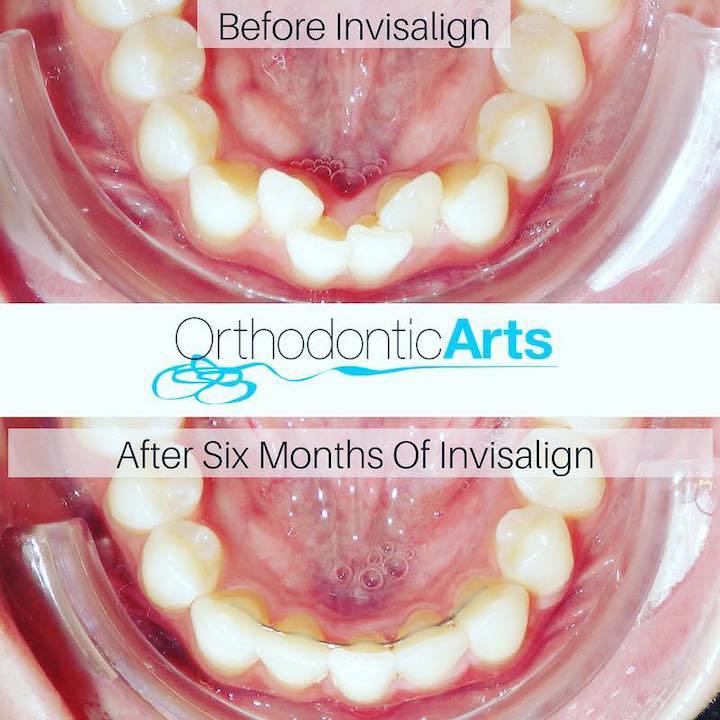 Images Orthodontic Arts