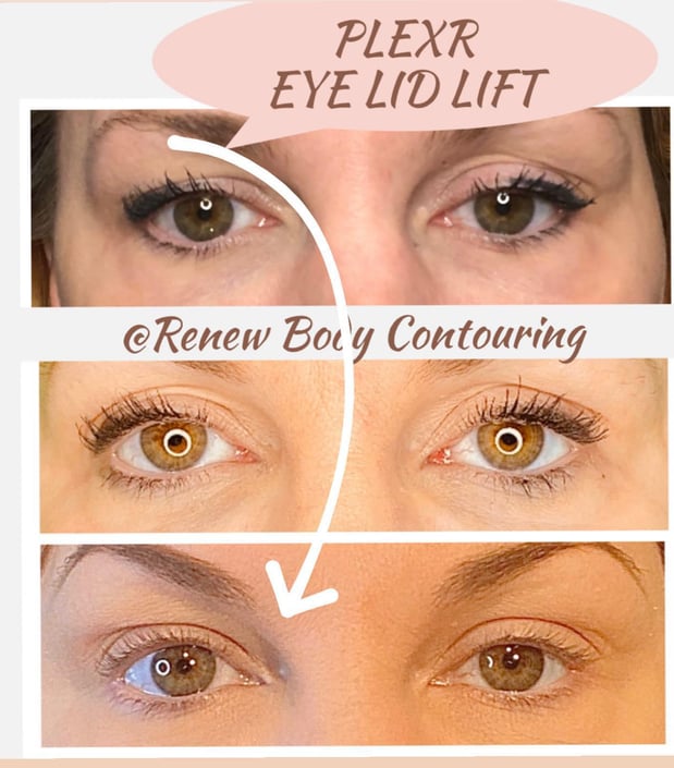 Images Renew Body Contouring & MedSpa