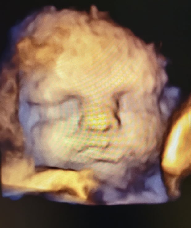 Images Love At First Sight 3D/4D Ultrasound Imaging Studio, LLC