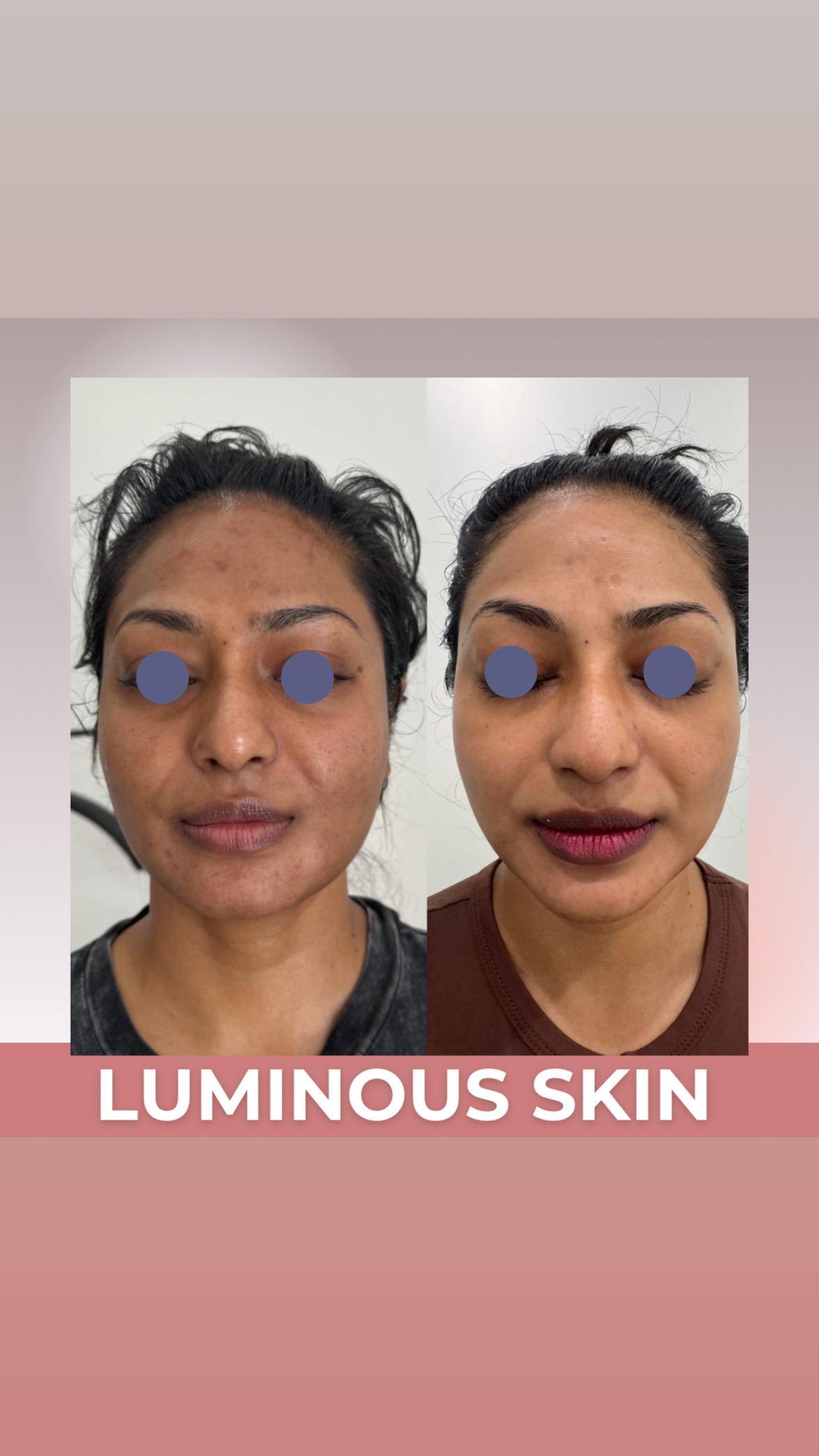 Images Luminous Skin