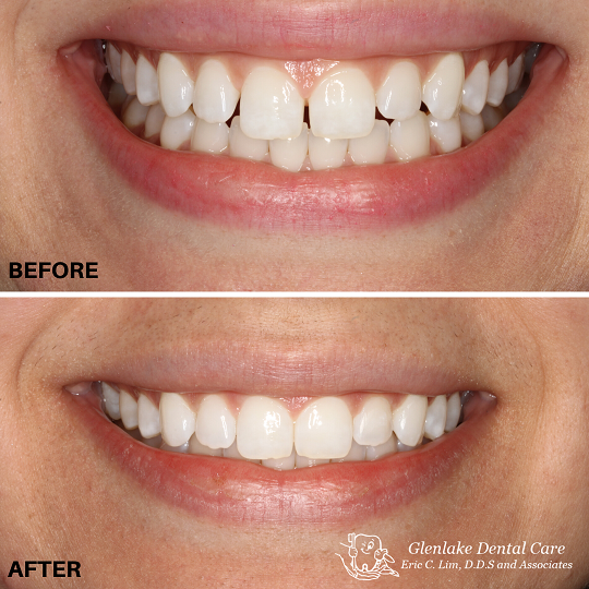 Images Glenlake Dental Care
