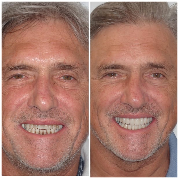 Images Reston Heights Dental