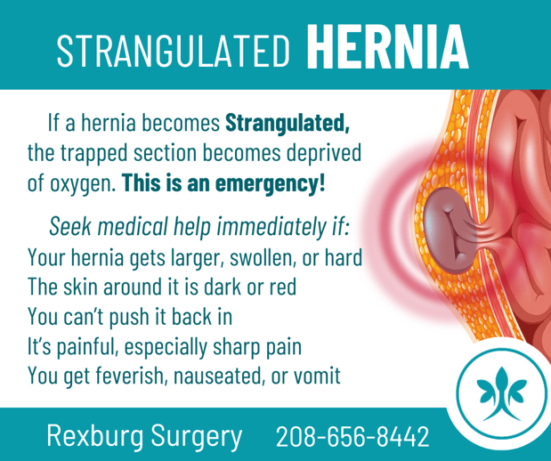 Images Rexburg Surgery
