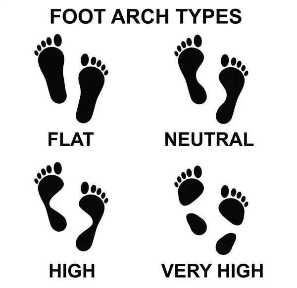 foot-arch-types-kcm-2.webp