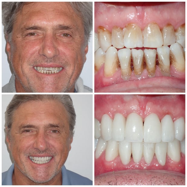 Images Reston Heights Dental