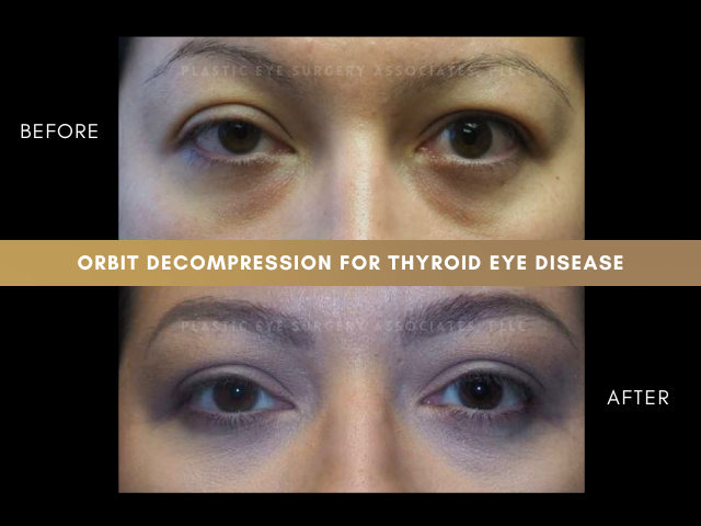 Images Plastic Eye Surgery Associates, PLLC