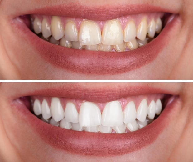 Images Silver State Dental