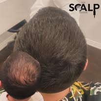Images The Scalp Master