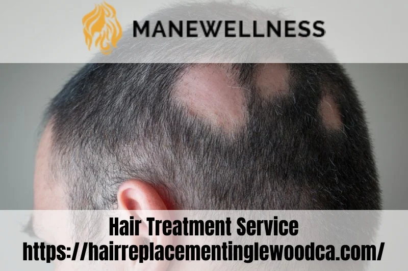 Images Mane Wellness Hair Loss Center