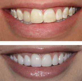 Images Smiles By Eddie: Dr. Edmond Ahdoot DDS