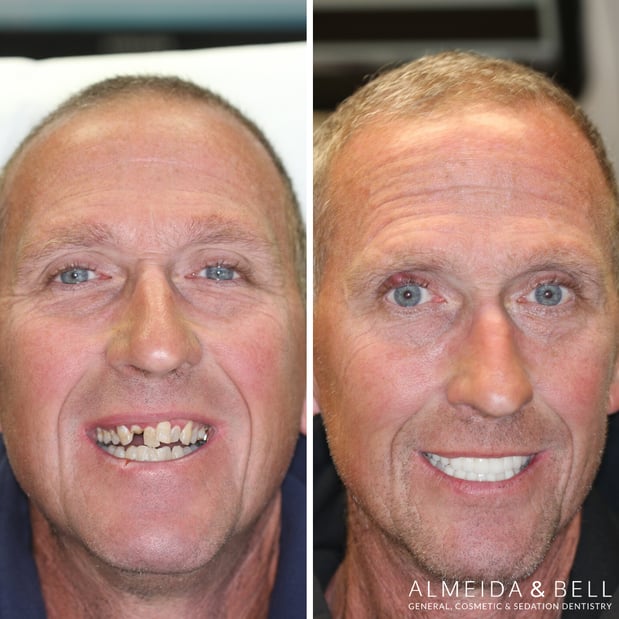Images Almeida & Bell Dental Lone Tree - General, Cosmetic, and Implant Dentistry