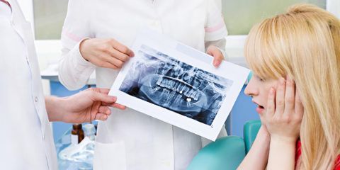 What Are Root Canals and Why Would You Need One?