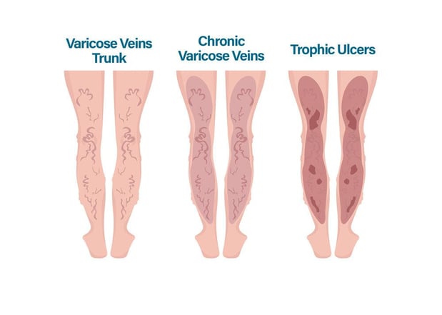 Images Physicians Vein Clinics